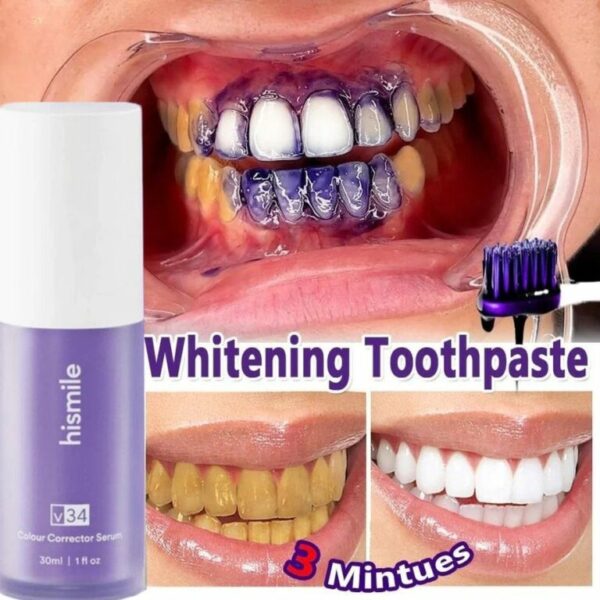 ashsay.com Hismile v34 Color Corrector Serum Instant Teeth Brightening Solution 30ml