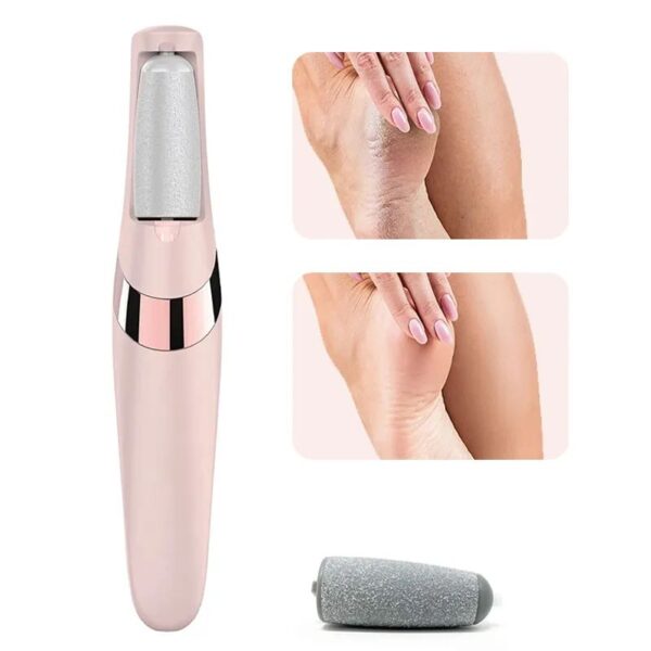 Professional Callus Remover