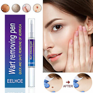 Quick Wart Removal Pen