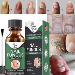 Nail Fungus Treatment 10ml