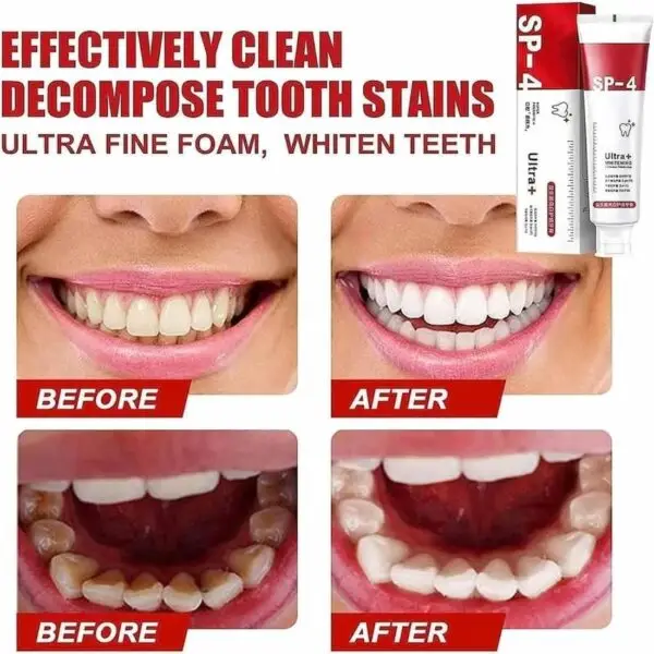 Buy Yayashi SP-4 Ultra Whitening Toothpaste in Pakistan – Removes stains, brightens teeth, and gives long-lasting fresh breath. Dentist-recommended formula.