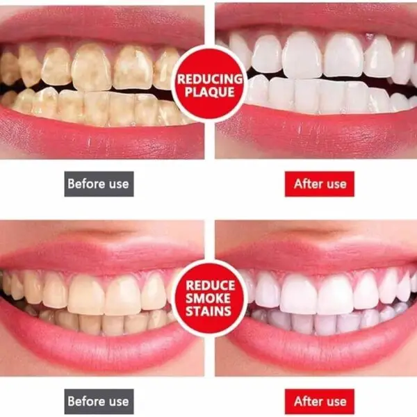 Buy Yayashi SP-4 Ultra Whitening Toothpaste in Pakistan – Removes stains, brightens teeth, and gives long-lasting fresh breath. Dentist-recommended formula.