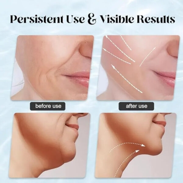3-in-1 Rechargeable Face & Neck Massager | Red Light Therapy + Microcurrent | Skin Lifting, Anti-Aging & Wrinkle Care | Random Color